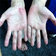 YOSA PARK 雲母　新潟市 ヨサパーク キララ yosa ヨサ 東区 よもぎ蒸し ダイエット YOSA PARK 雲母 